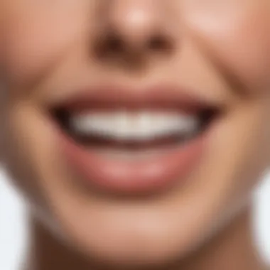 Teeth Whitening Results with Auraglow Before and after comparison of teeth whitening results