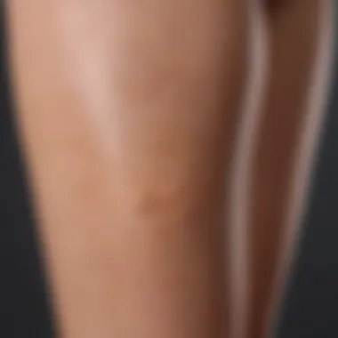 Spot on Leg Skin Close-up of smooth leg skin showing a spot before treatment